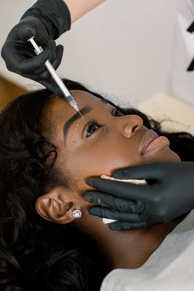 Dermal Fillers